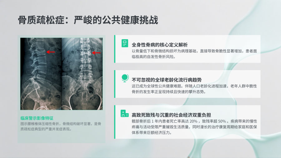 地舒单抗治疗骨质疏松临床应用指南解读 第 3 页