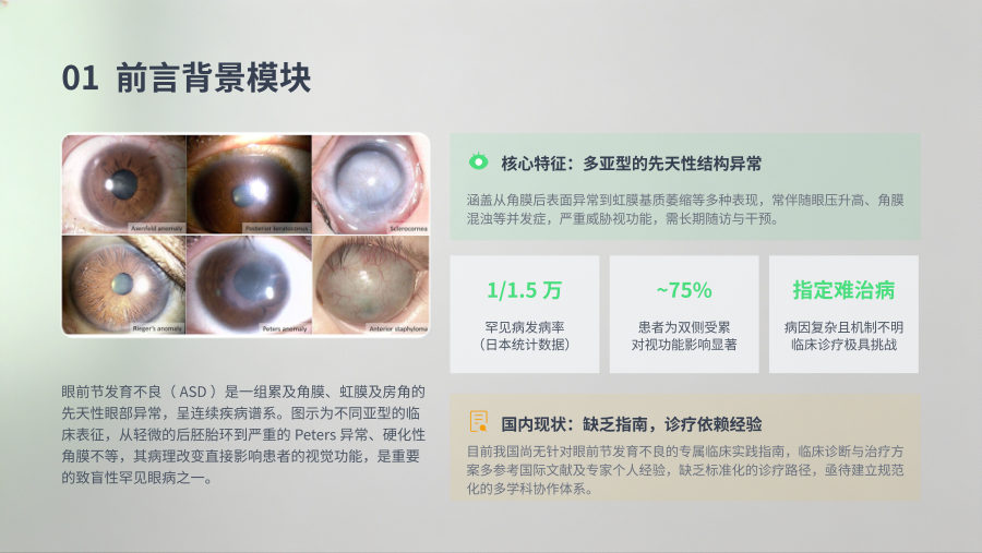 眼前节发育不良临床实践指南解读 第 2 页