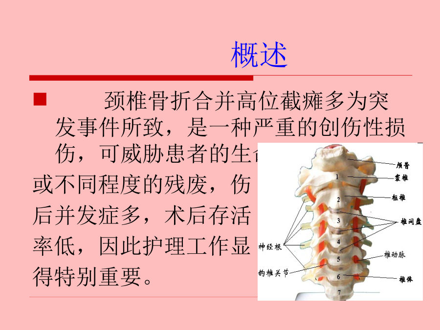 颈椎骨折病人术前护理 第 2 页