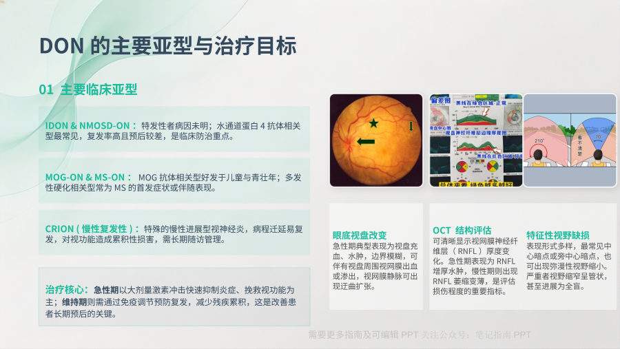 中国脱髓鞘性视神经炎靶向生物制剂治疗专家共识（2026年）解读 第 3 页